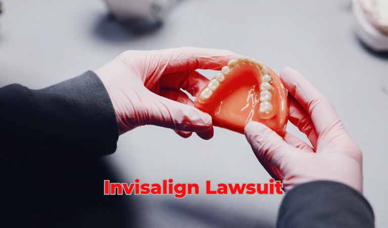 Invisalign Lawsuit